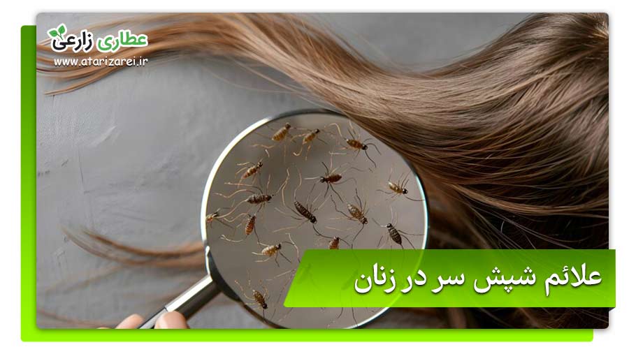 علائم شپش سر در کودکان، زنان و... چیست؟ 6 علائم شپش سر در زنان