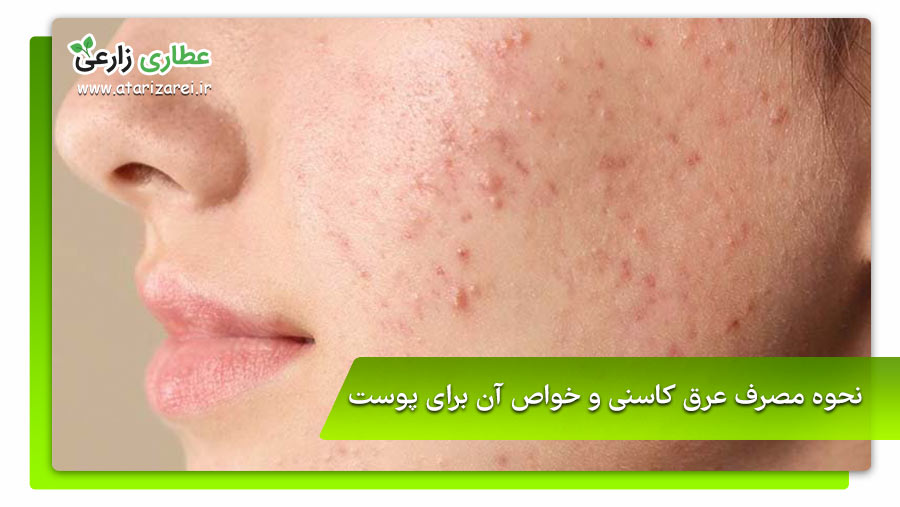 نحوه مصرف عرق کاسنی و خواص شگفتانگیز آن! 16 نحوه مصرف عرق کاسنی برای کبد چرب