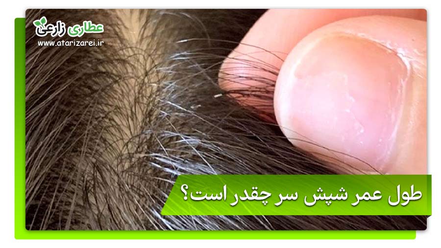 علائم شپش سر در کودکان، زنان و... چیست؟ 8 طول عمر شپش سر چقدر است؟